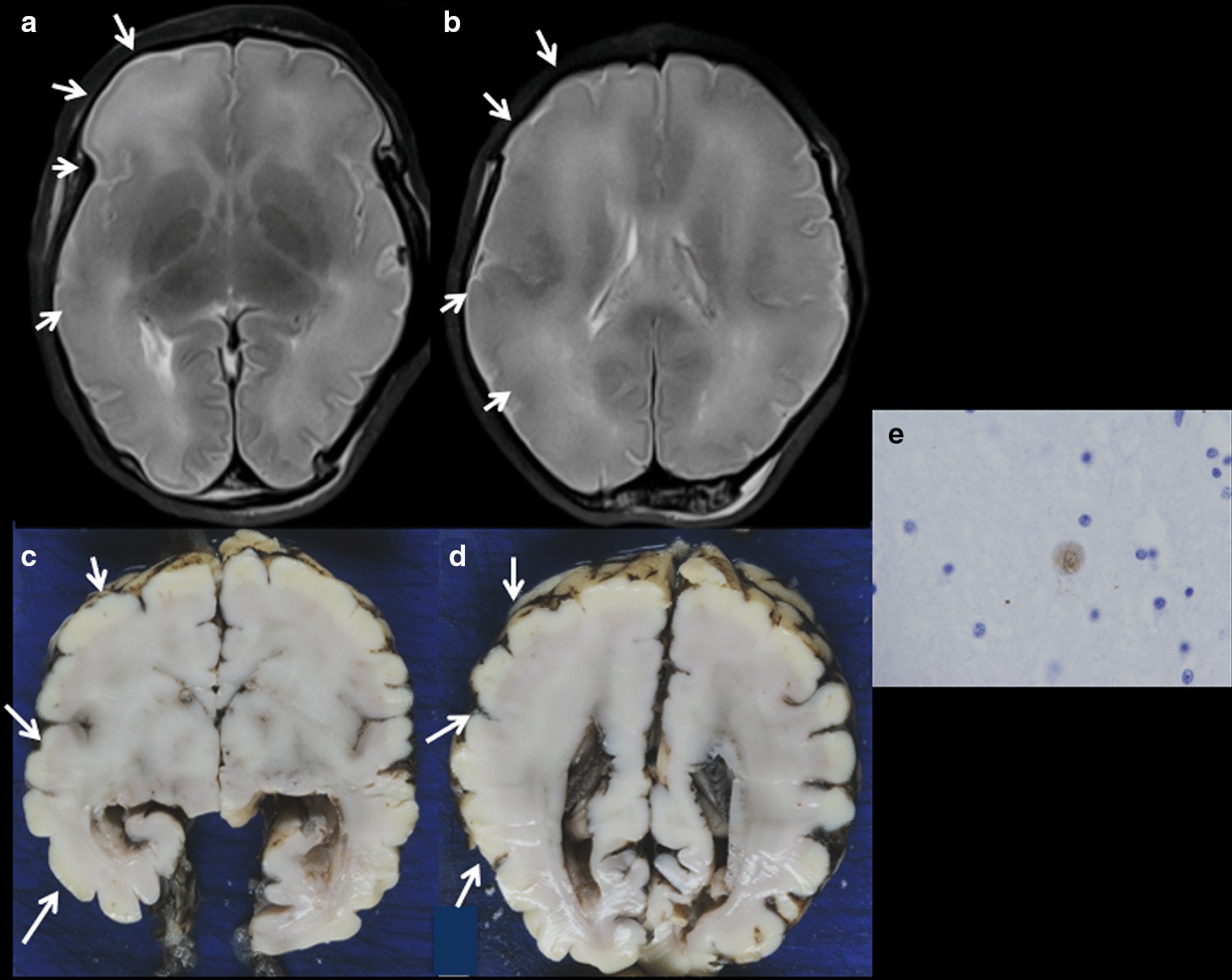 Fig. 13