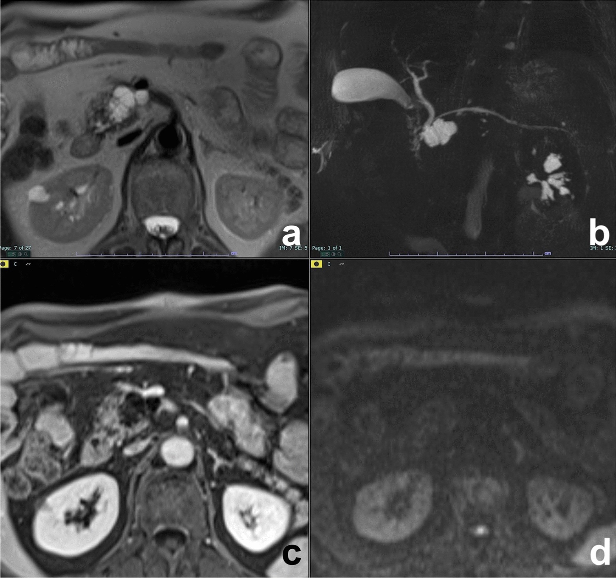 Fig. 17