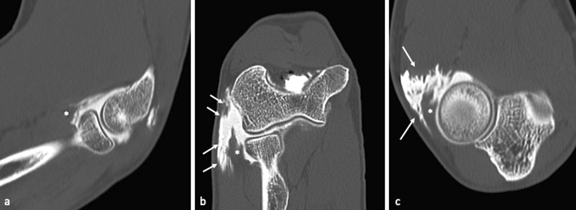 Fig. 9