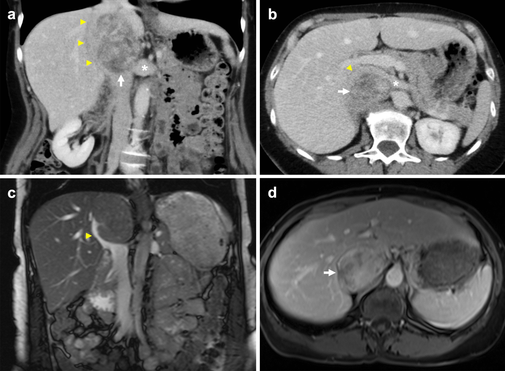 Fig. 13