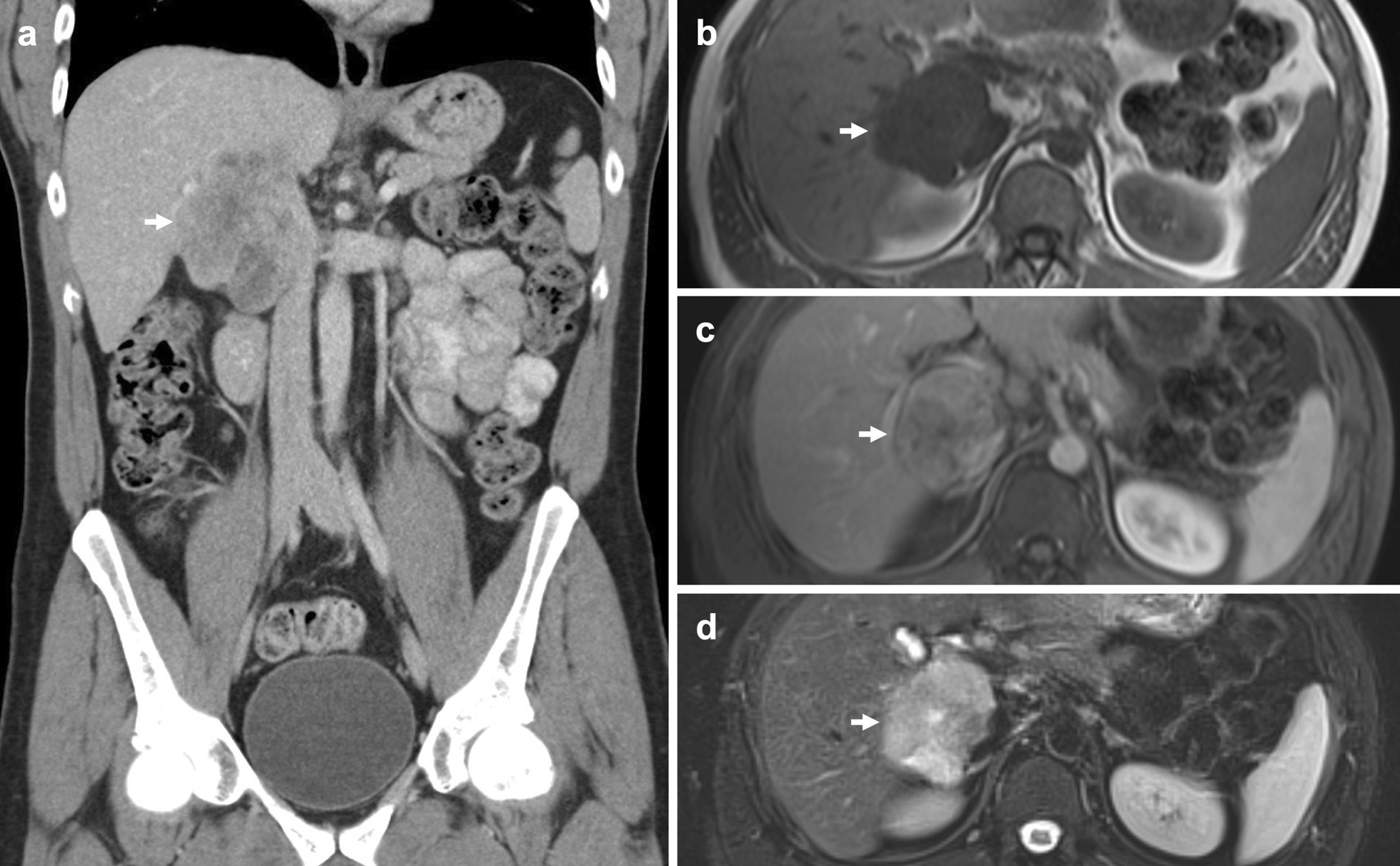 Fig. 14