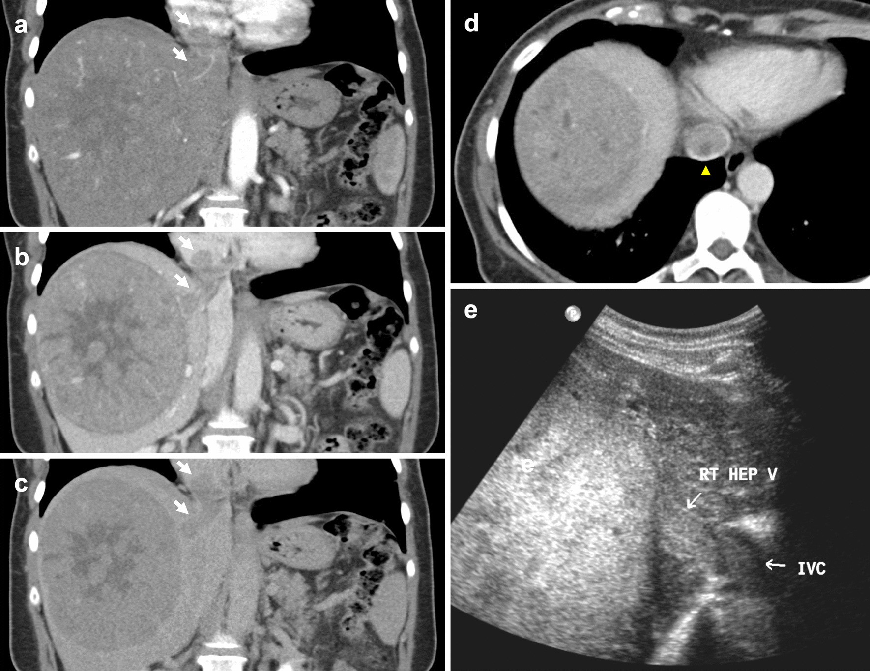 Fig. 18