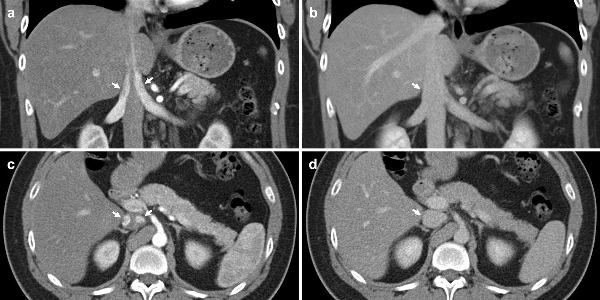 Fig. 23