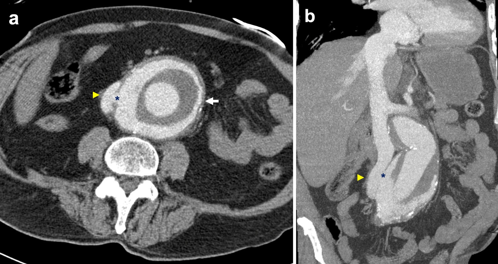 Fig. 26