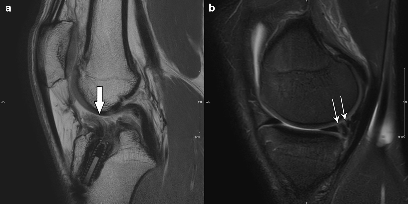 Fig. 15