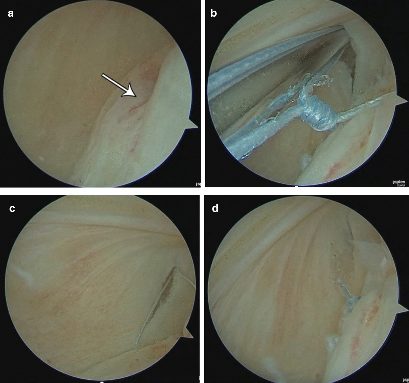 Fig. 16