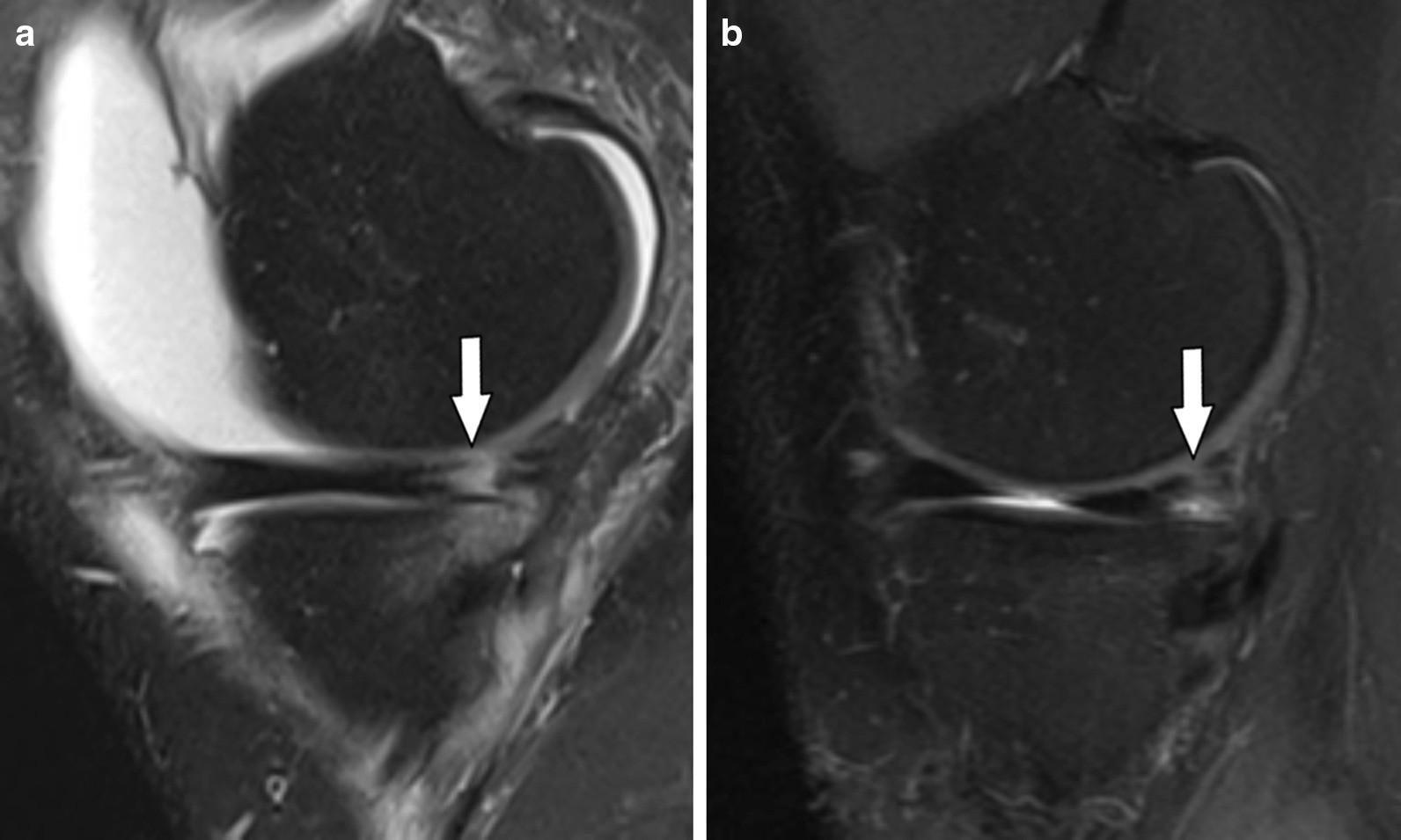 Fig. 17