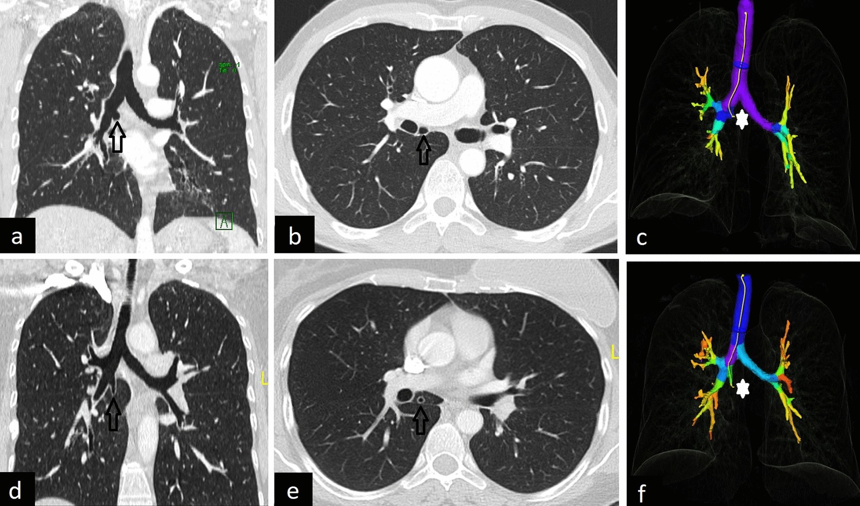 Fig. 13