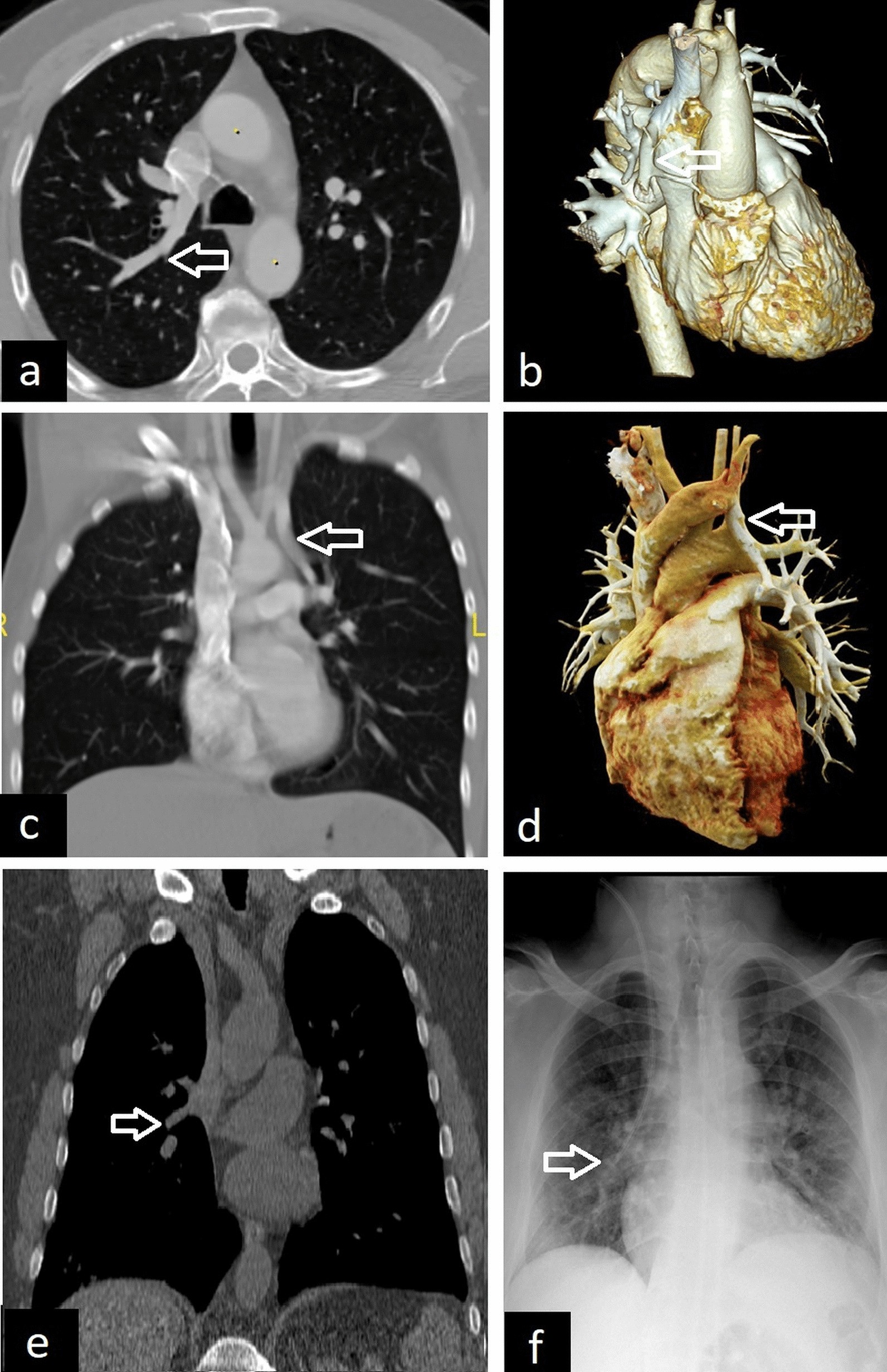 Fig. 20