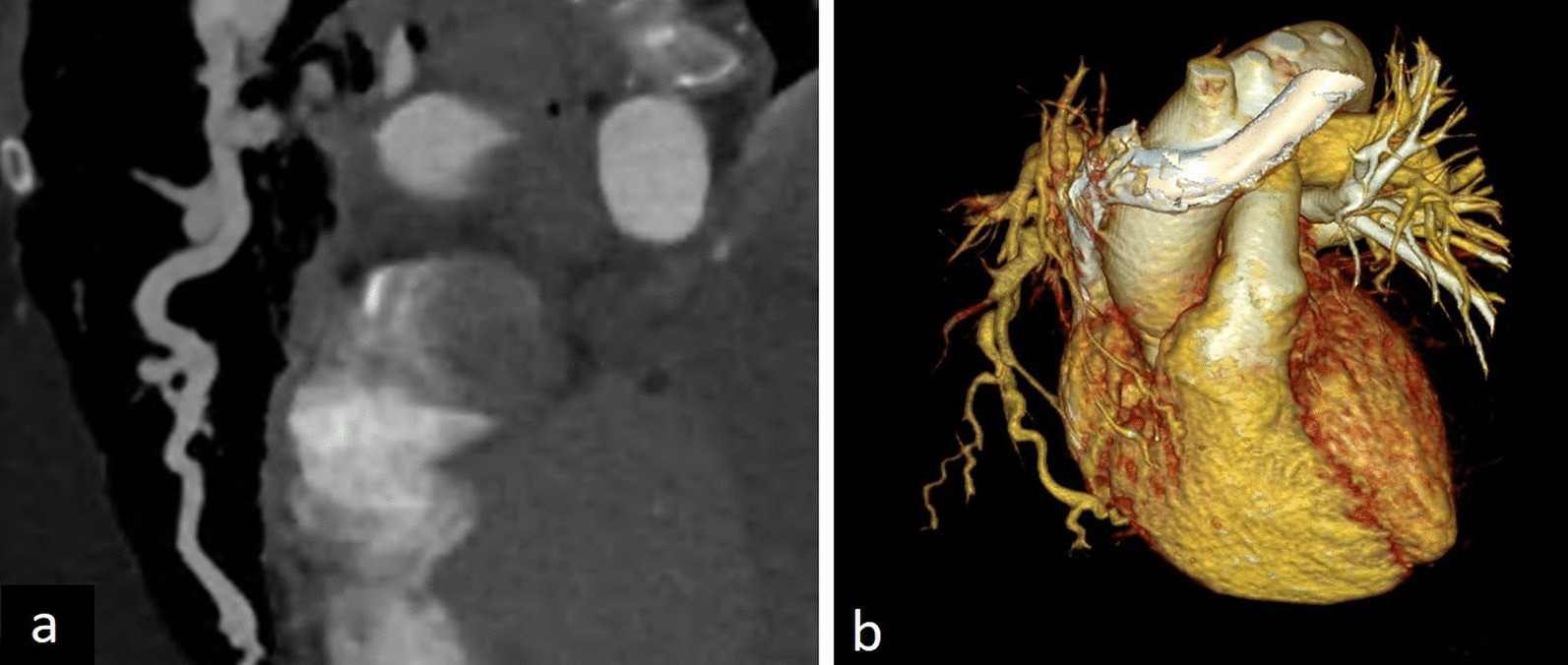 Fig. 21