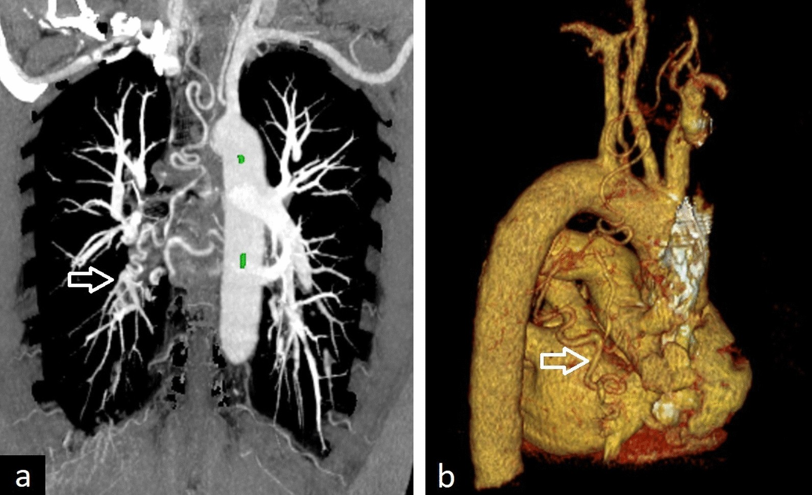 Fig. 23