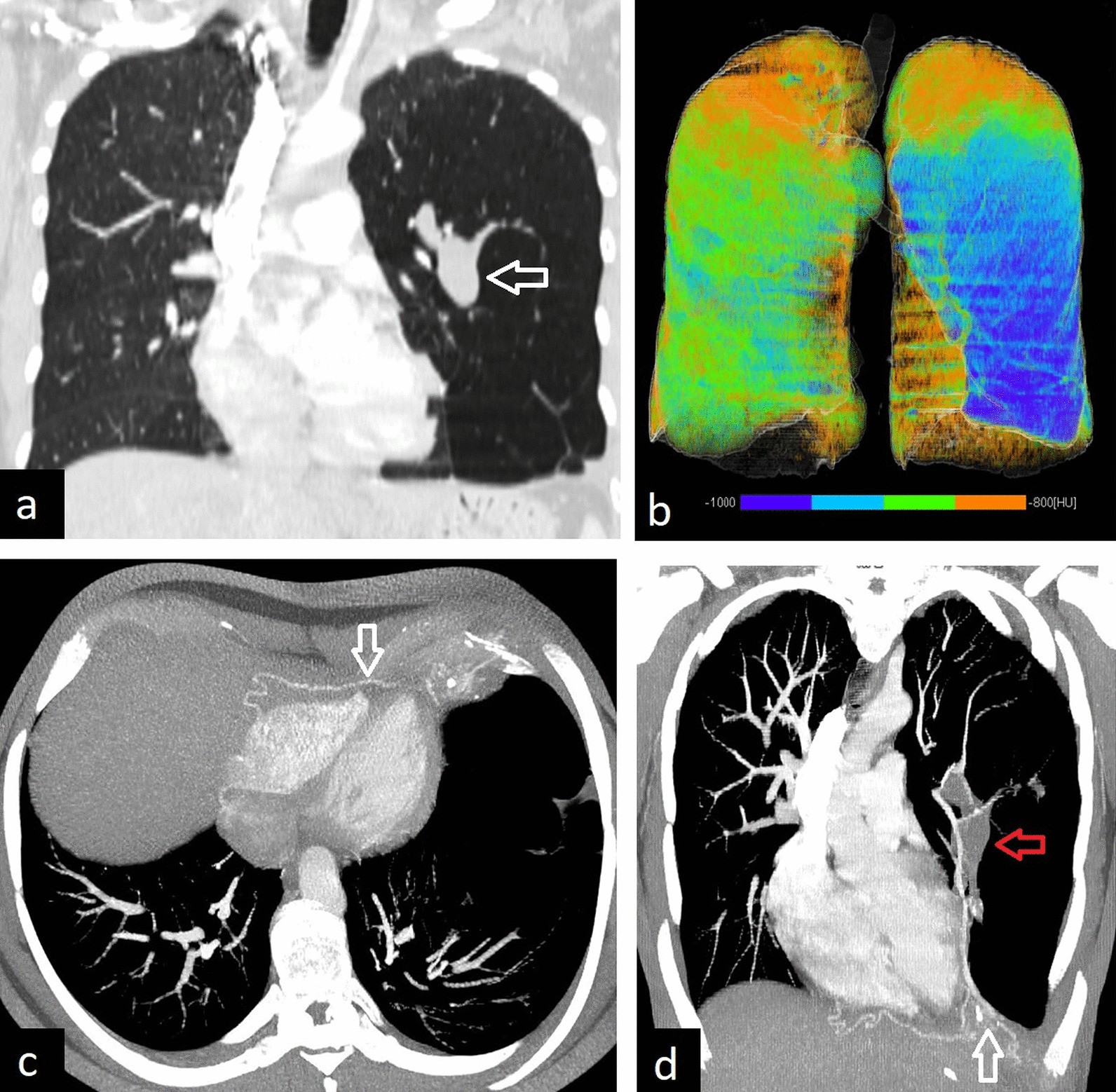 Fig. 27