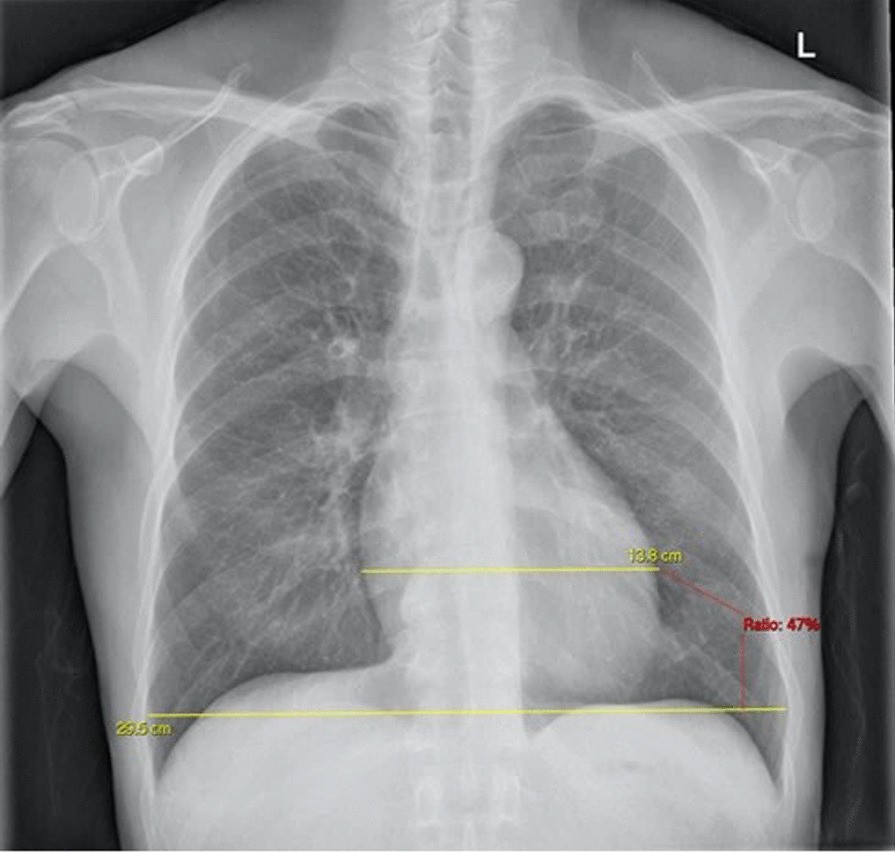 Fig. 2