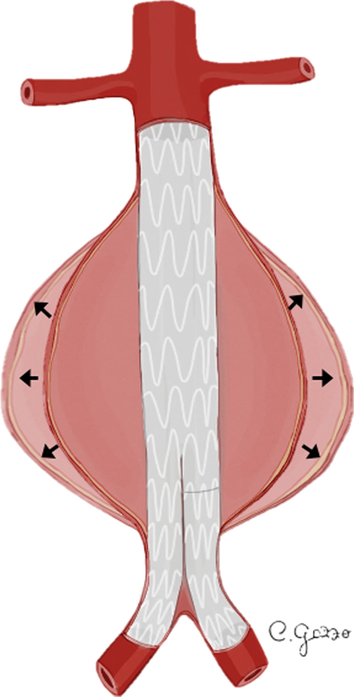 Fig. 10