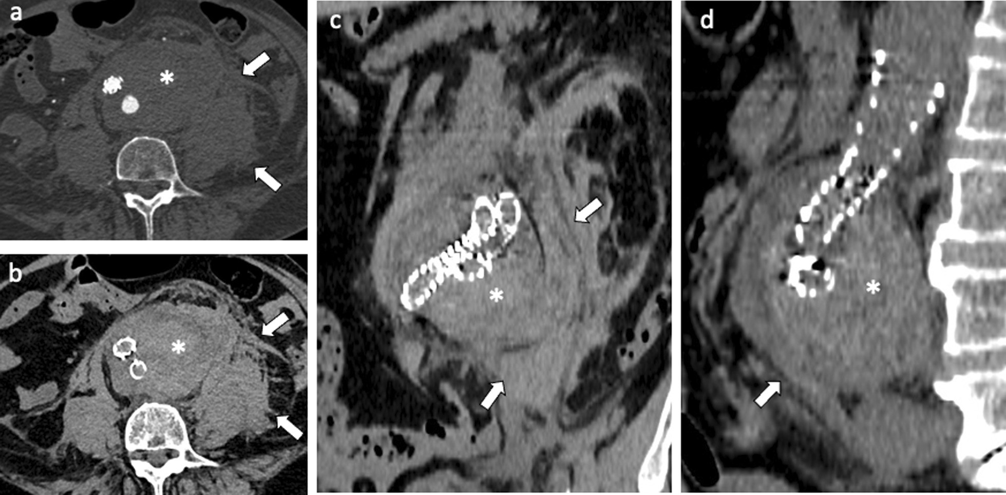 Fig. 11