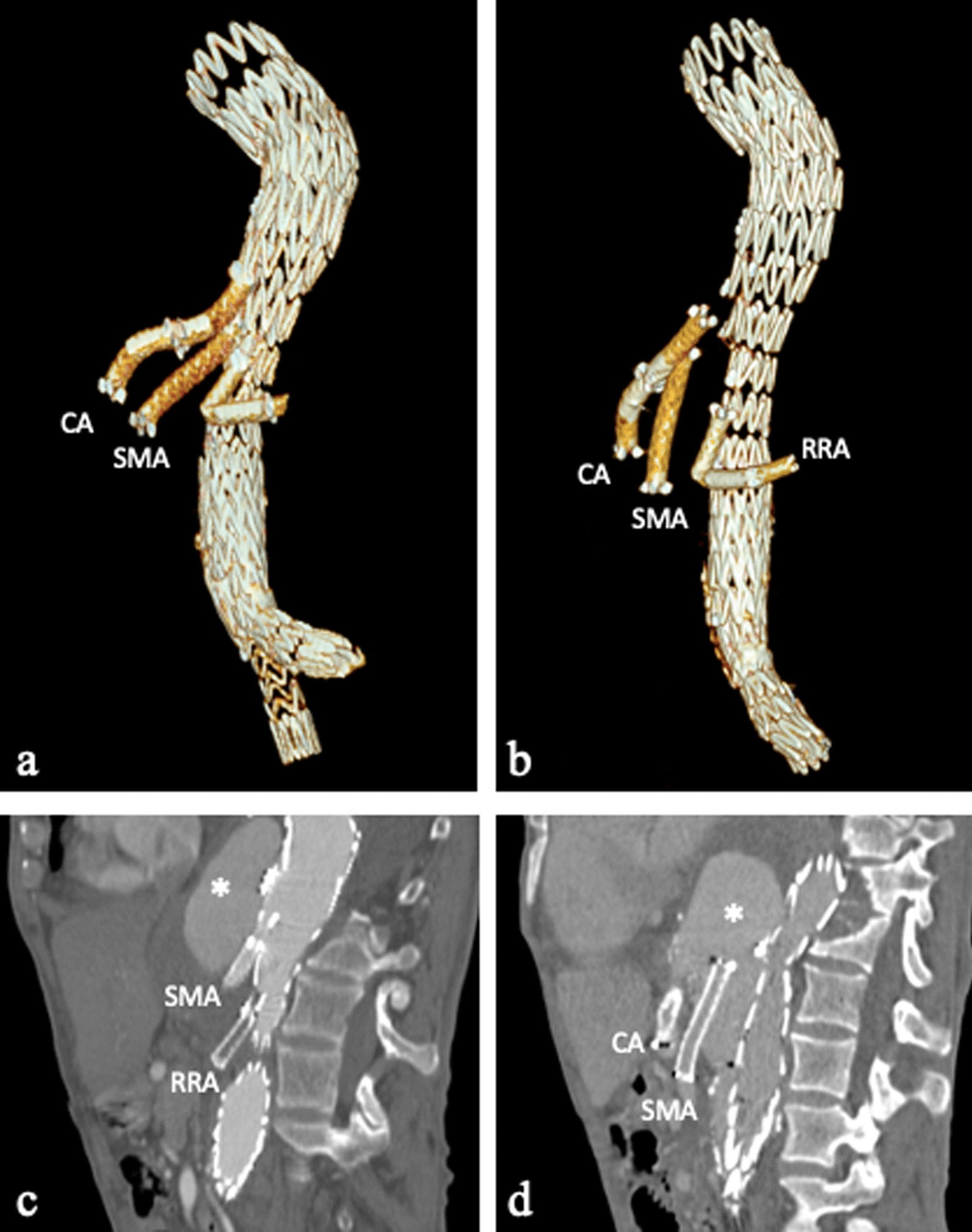 Fig. 13