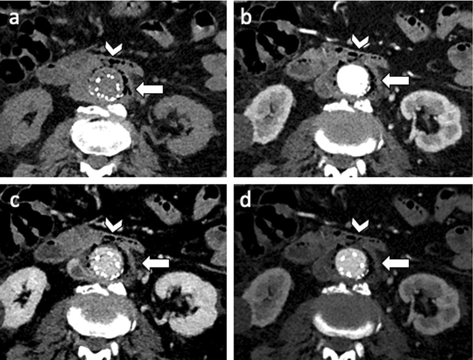 Fig. 16