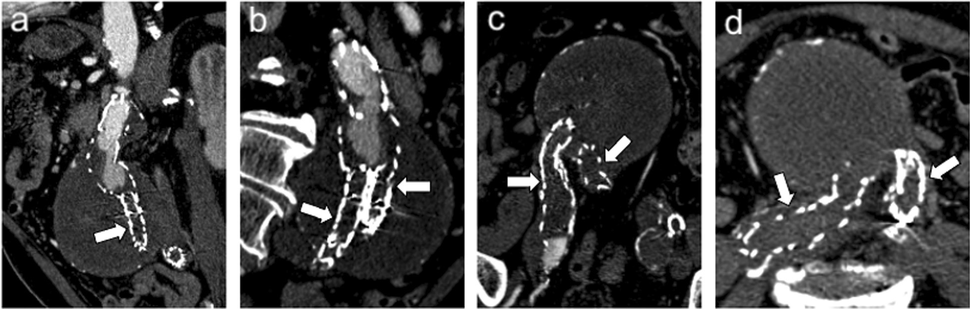 Fig. 18