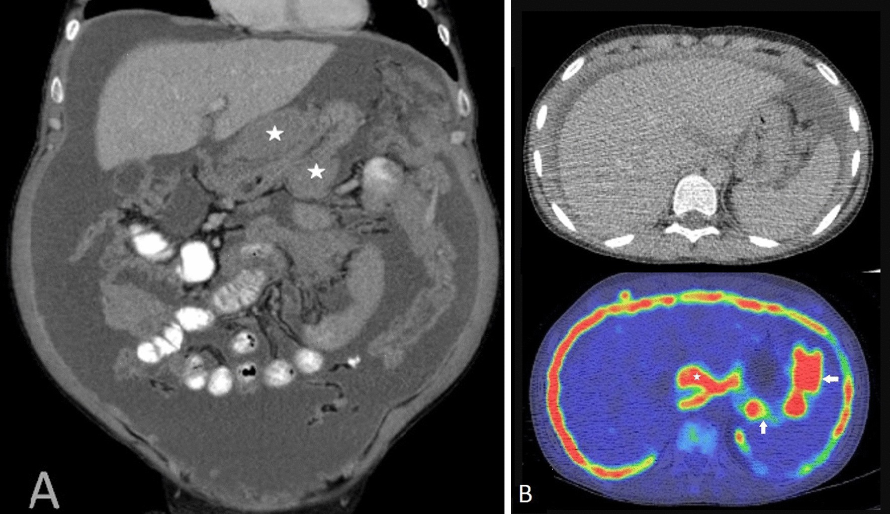 Fig. 13