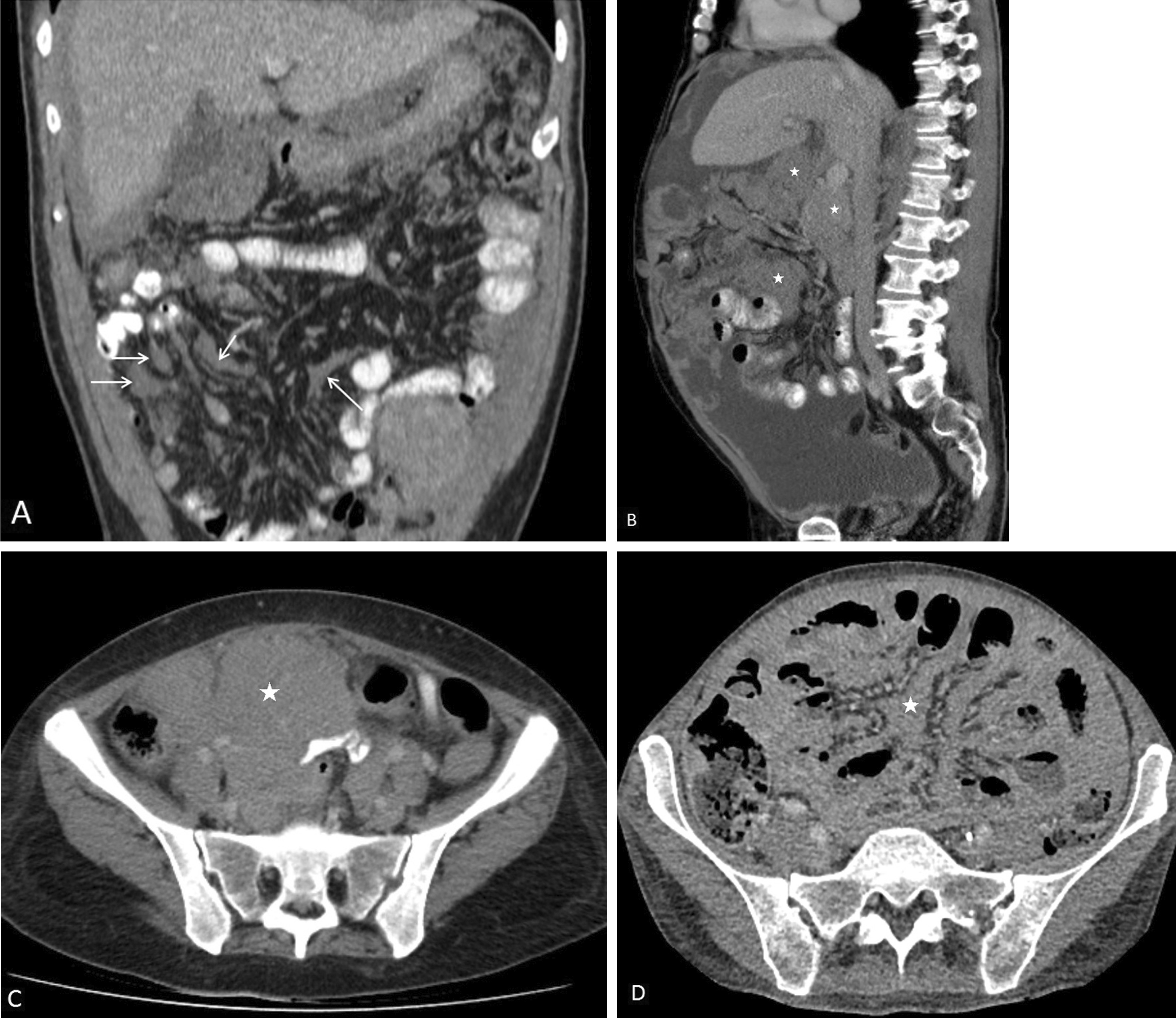 Fig. 16