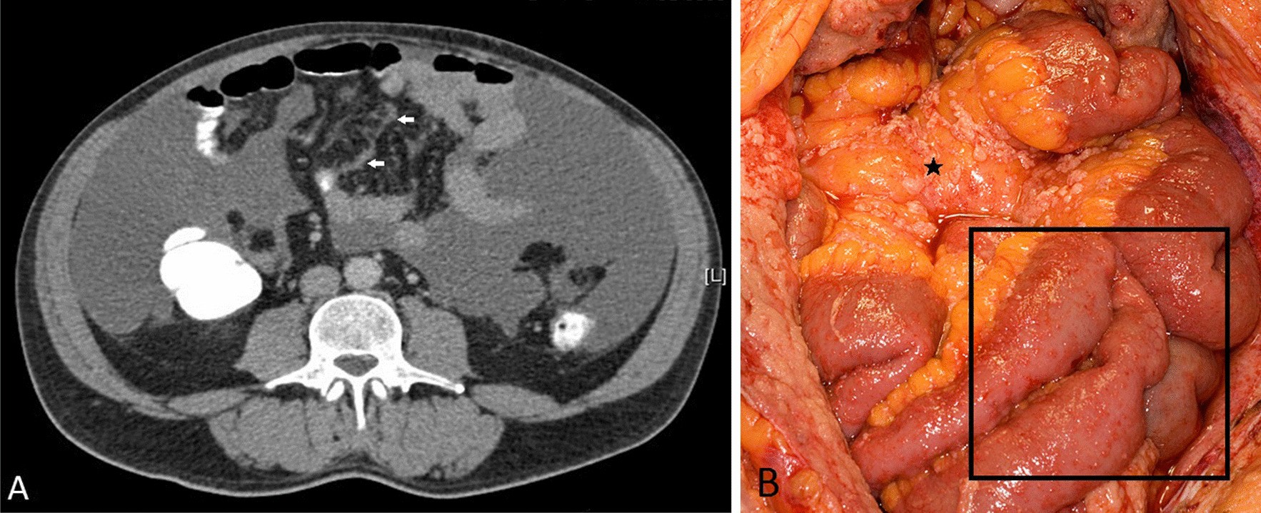 Fig. 19