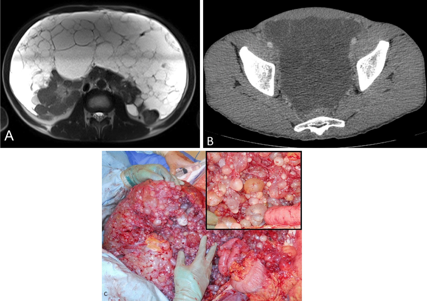 Fig. 2