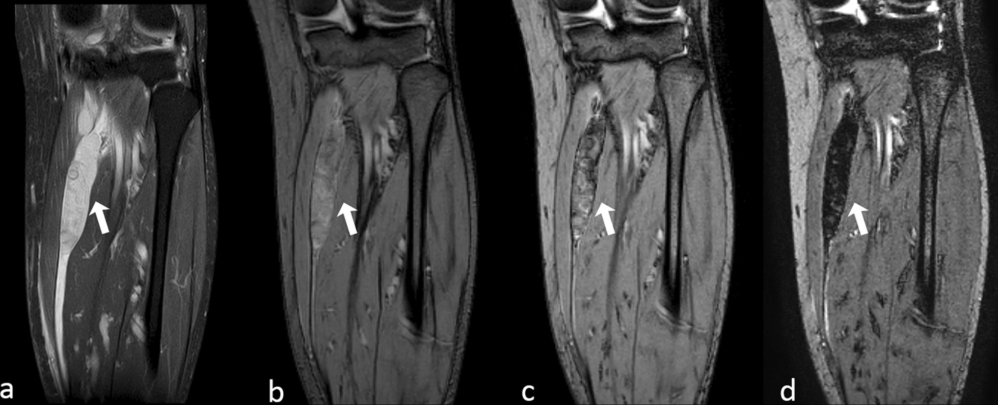 Fig. 10