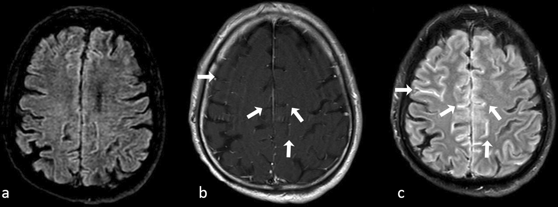 Fig. 15