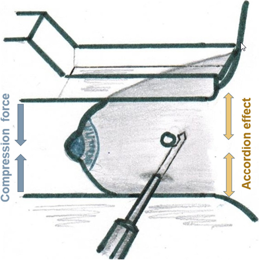 Fig. 2