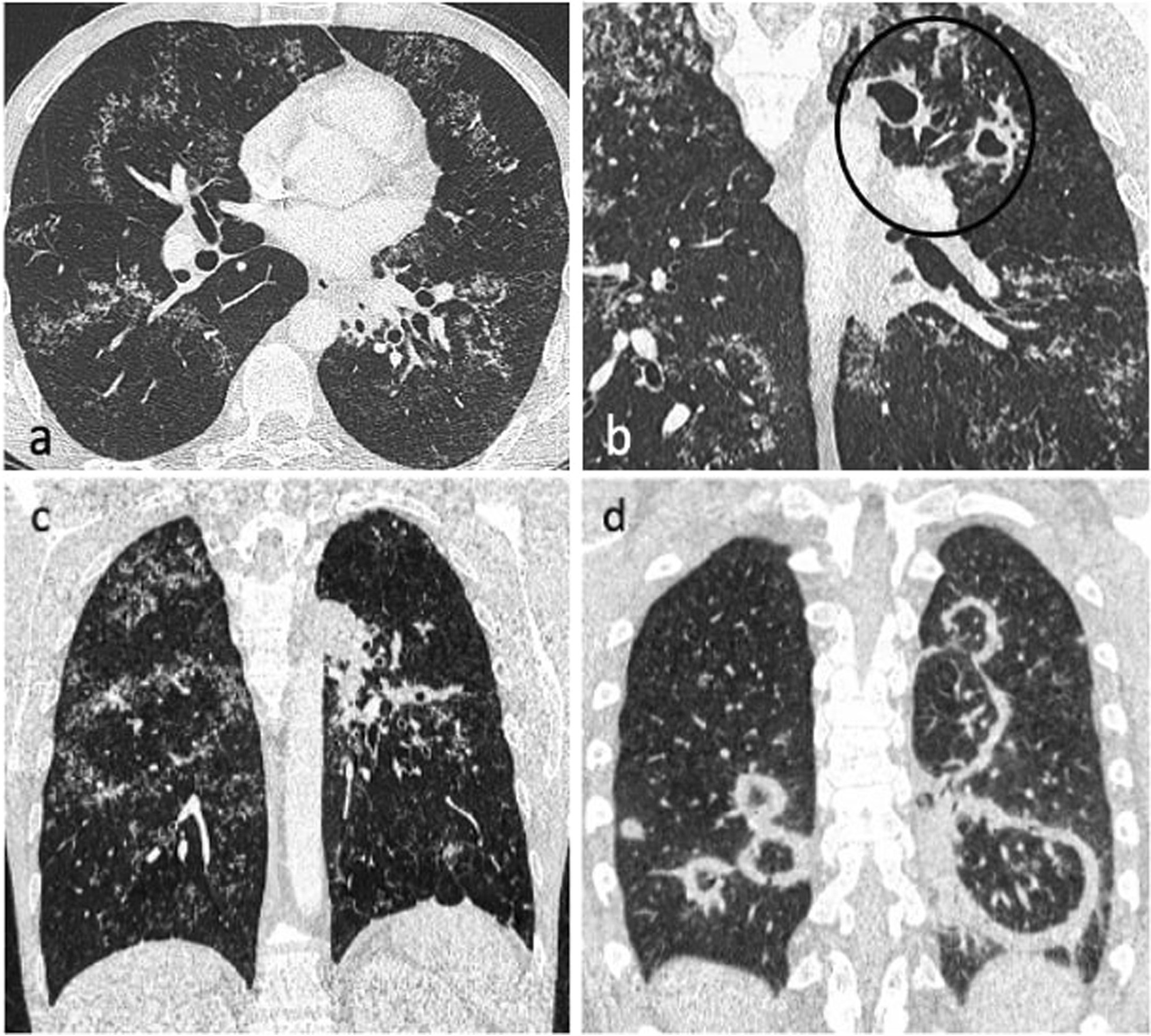 Fig. 11