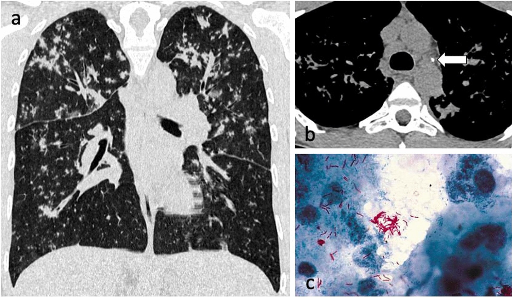 Fig. 12