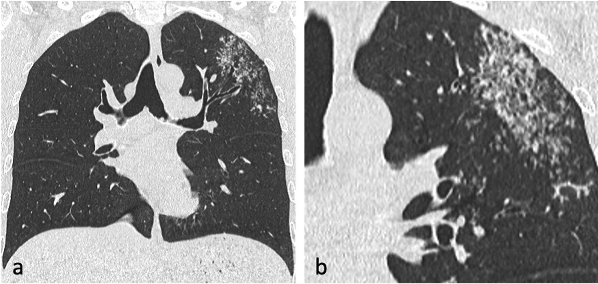 Fig. 7