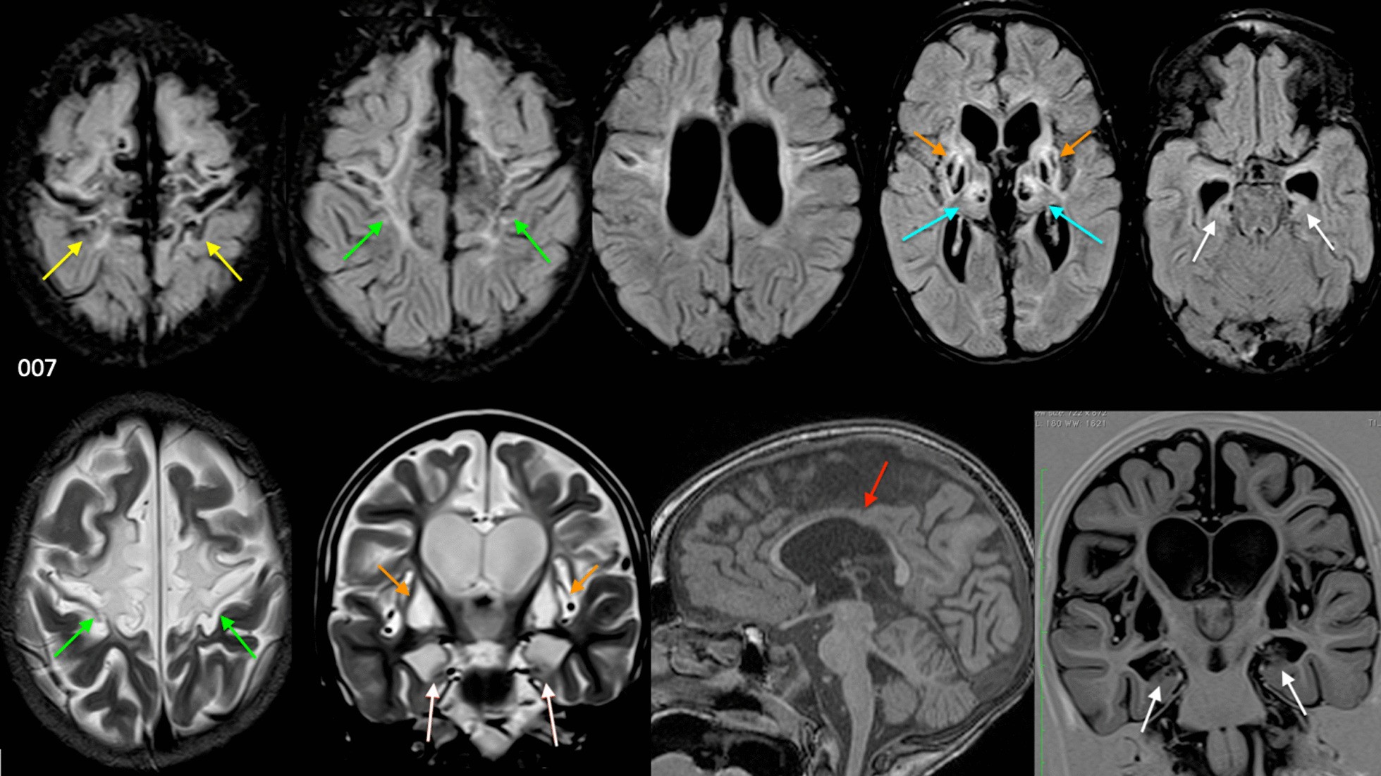 Fig. 7