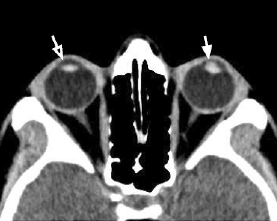 Fig. 13