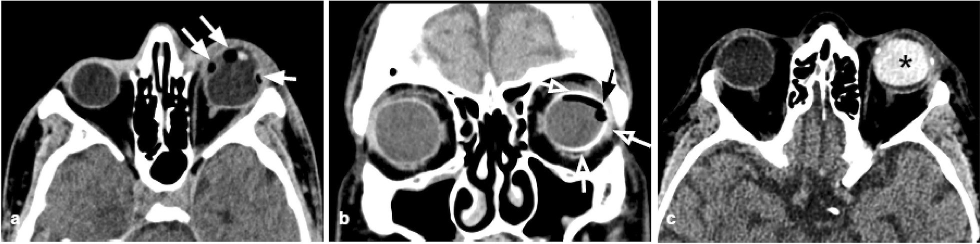 Fig. 20