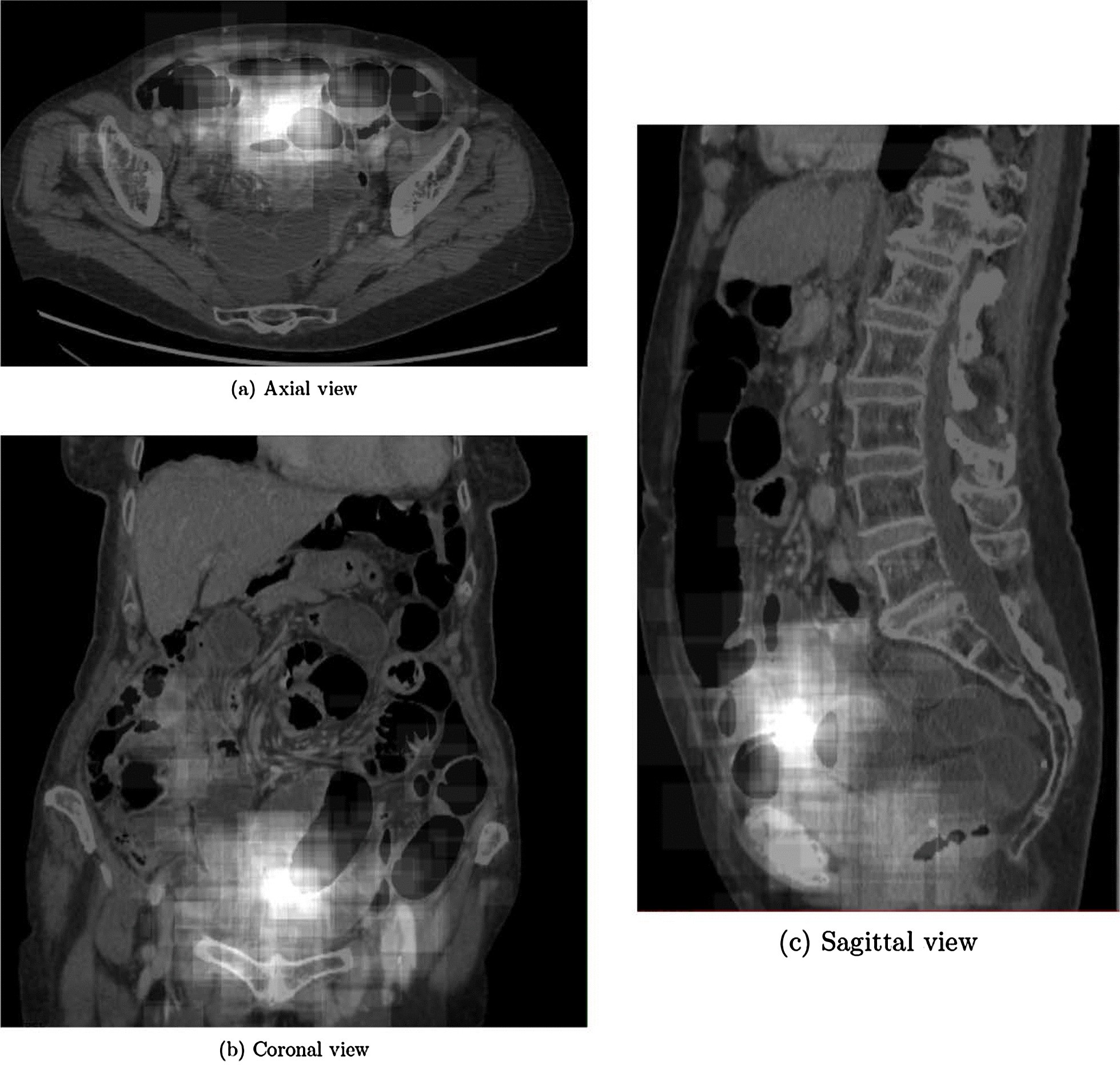 Fig. 3