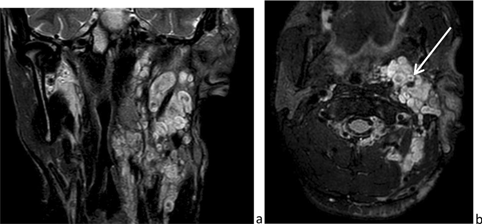 Fig. 15