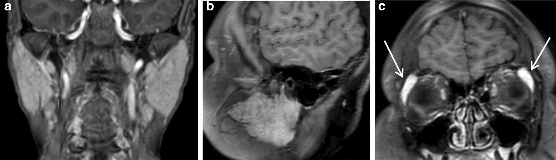 Fig. 21