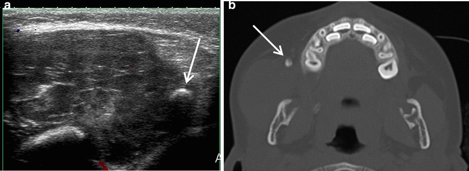 Fig. 24