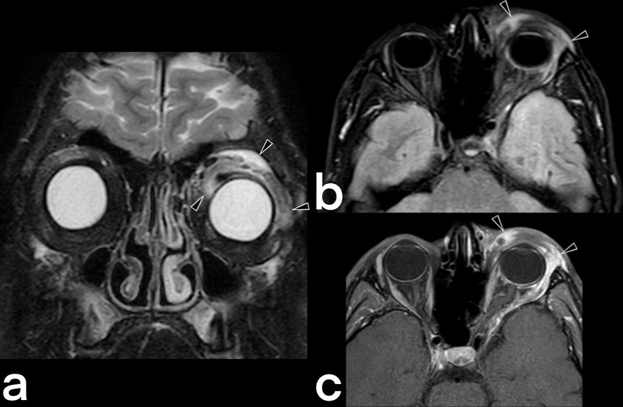 Fig. 13