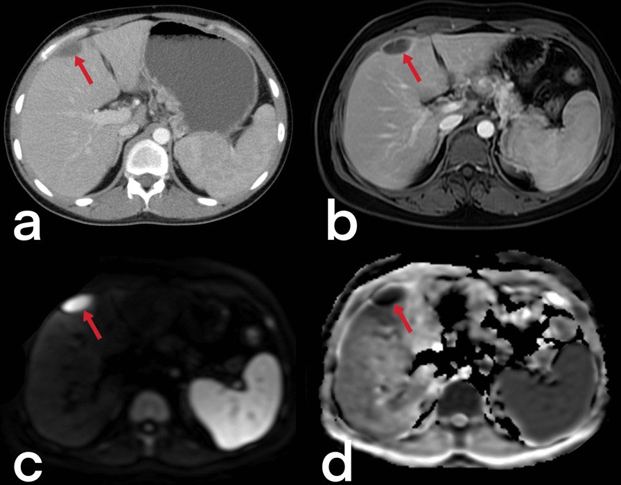 Fig. 30