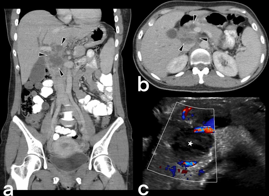 Fig. 32