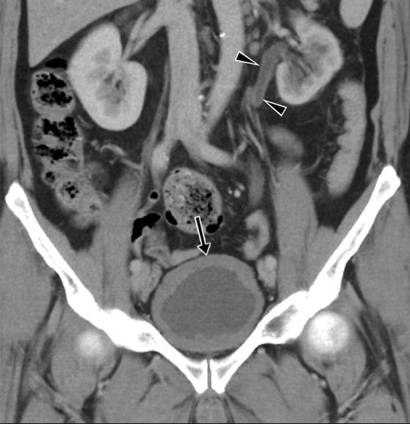 Fig. 38