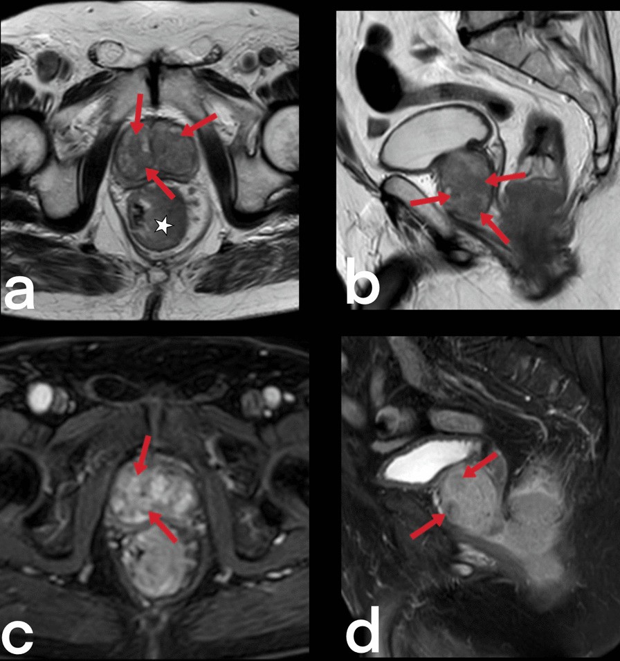 Fig. 39