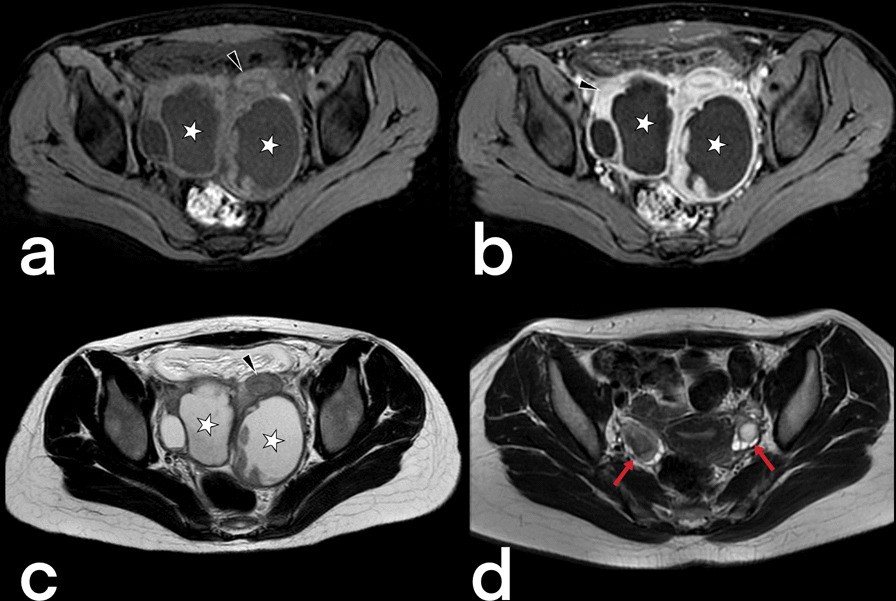 Fig. 41