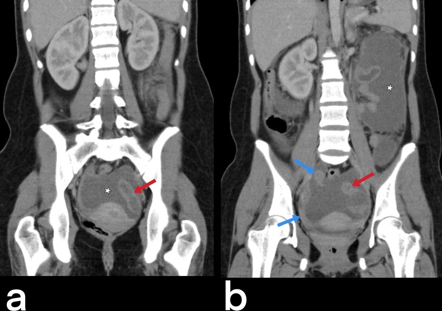 Fig. 42