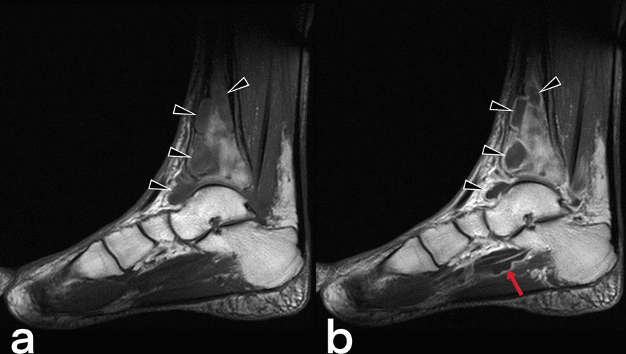 Fig. 52