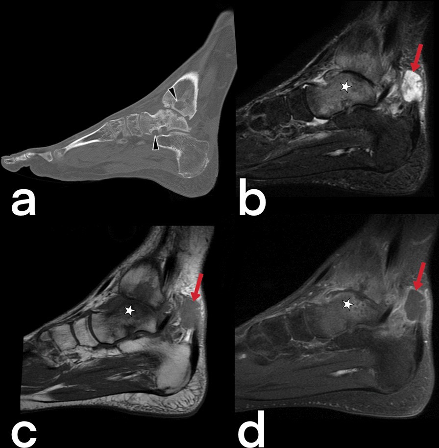 Fig. 53