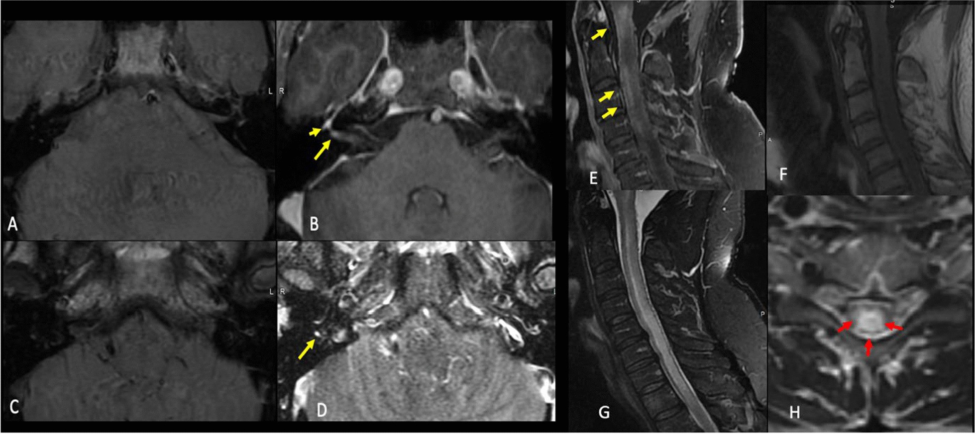 Fig. 5