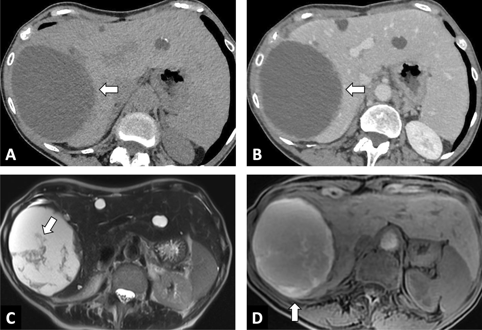 Fig. 14